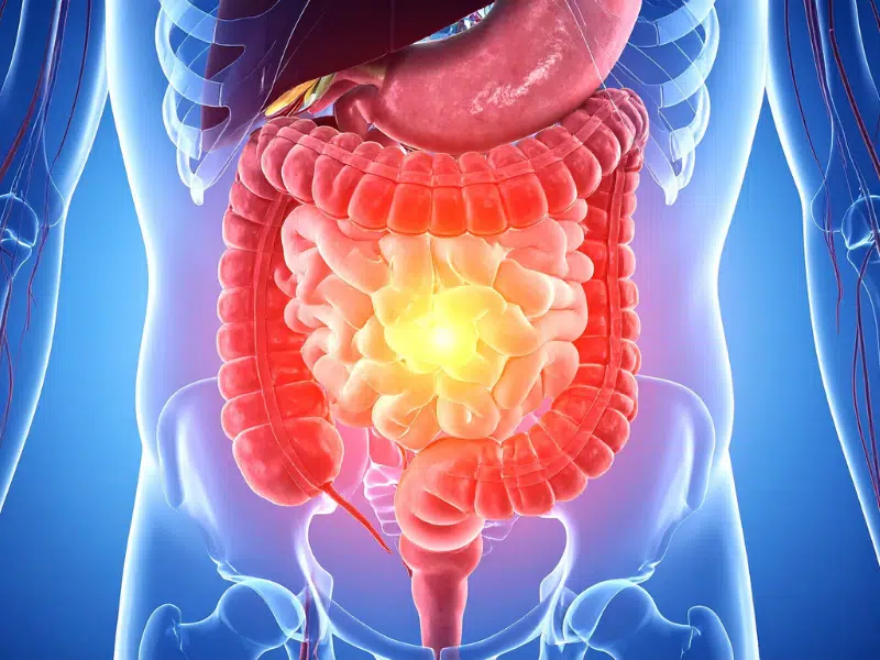 les saboteurs de votre digestion et confort intestinal
